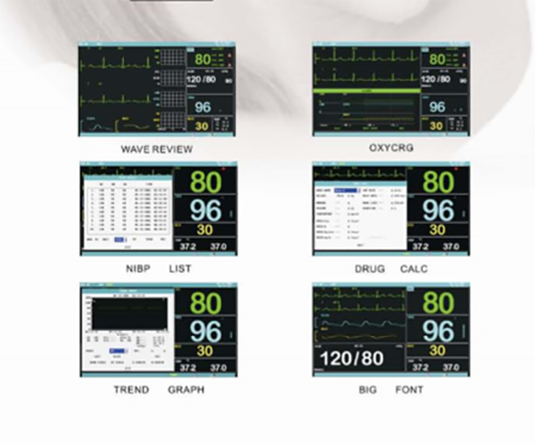 High Quality 7 Inch Color Touch Screen TR-900L medical ECG/SPO2 patient monitor for ICU/CCU for sale